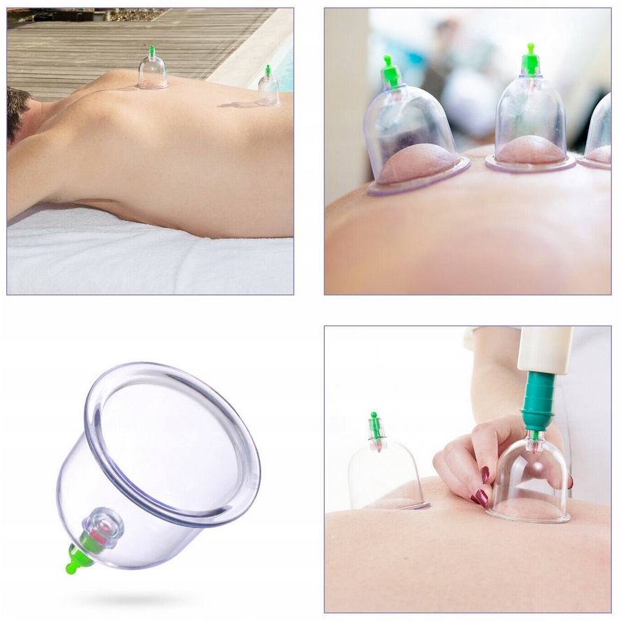 Bańki chińskie próżniowe bezogniowe masażer masaż cellulit zestaw 12szt - obrazek 4